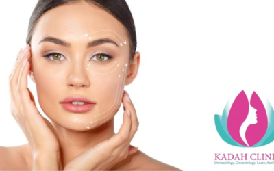 Conditions for facial laser treatment: Your guide to achieving perfect and safe skin