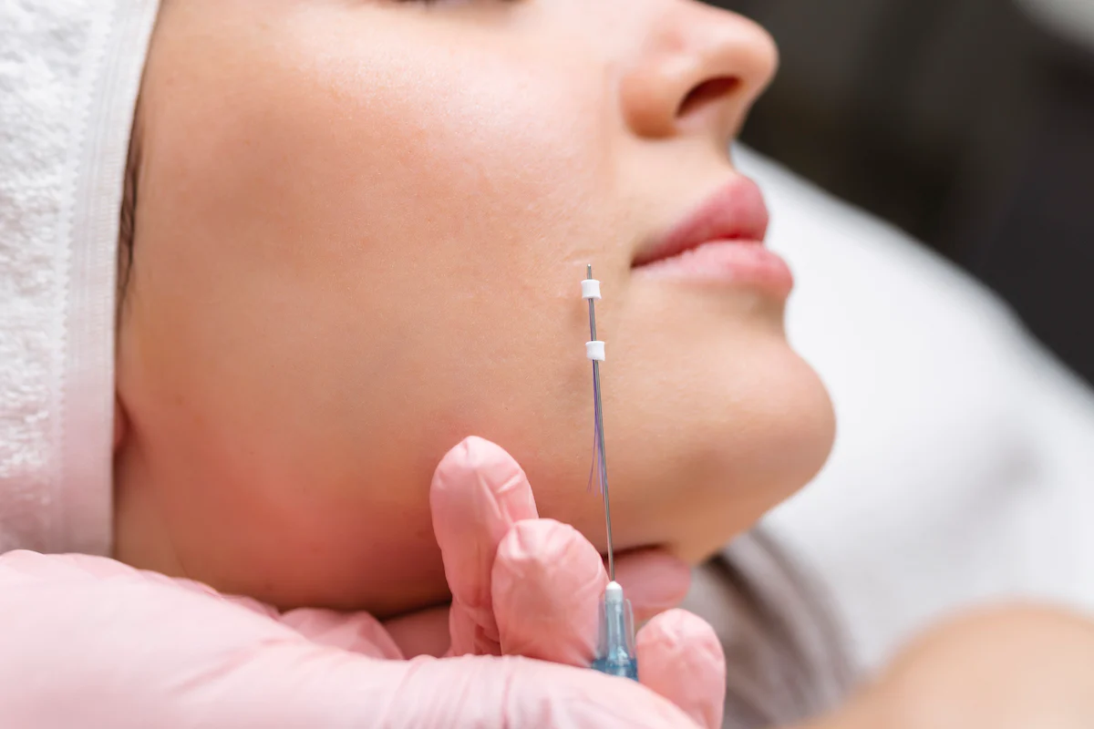 blog_banner_pdo-thread-lift-treatment-procedure-benefits-and-complications